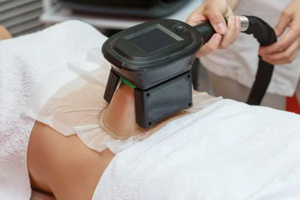 Image of person having fat freezing treatment to help weight gain Southend