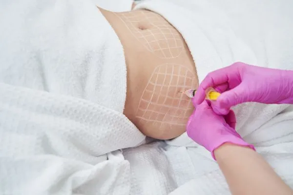 image of fat dissolving injections on love handles to help combat weight gain Southend