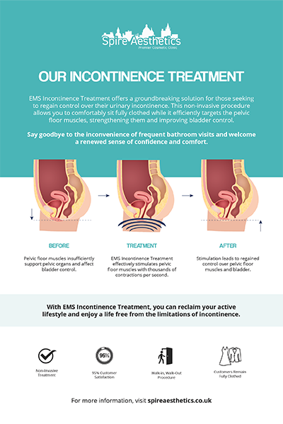 image to show how EMS treatment works for female urinary incontinence Southend