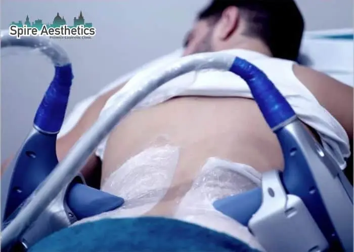 Man having fat freezing treatment done on love handles before a competitions Southend to create a sculpted look.