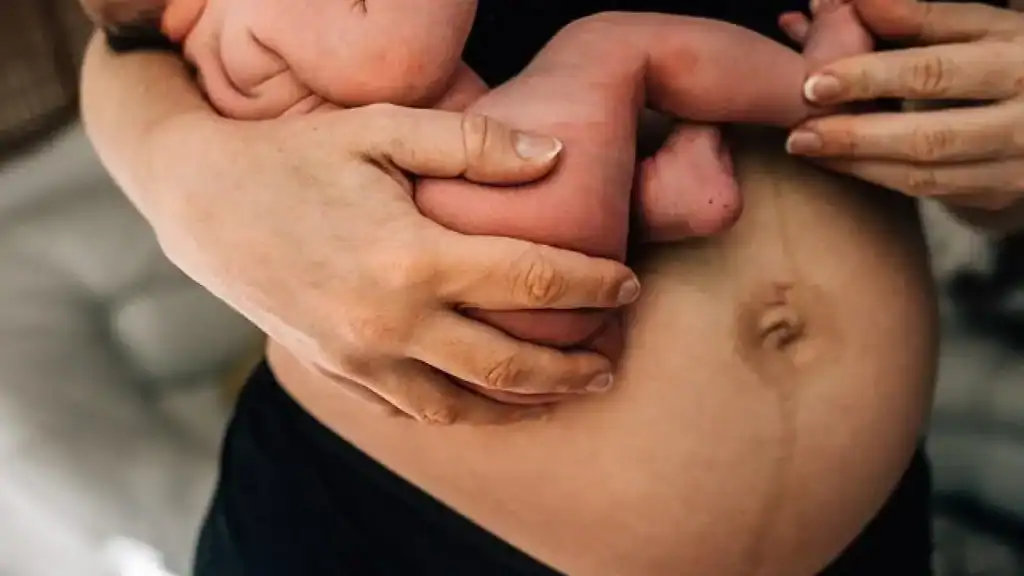 Why Is My Stomach Still Big After Pregnancy Southend?